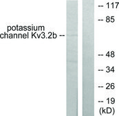 Anti-Potassium Channel Kv3.2b antibody produced in rabbit affinity isolated antibody