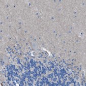 Anti-EGFR antibody produced in rabbit Prestige Antibodies® Powered by Atlas Antibodies, affinity isolated antibody, buffered aqueous glycerol solution