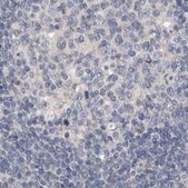 Anti-MRPL18 antibody produced in rabbit Prestige Antibodies® Powered by Atlas Antibodies, affinity isolated antibody, buffered aqueous glycerol solution, ab2