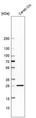 Anti-MBP antibody produced in rabbit Prestige Antibodies® Powered by Atlas Antibodies, affinity isolated antibody