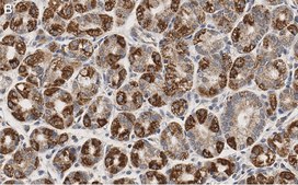 Anti-GSDMD Antibody, clone 1D11 ZooMAb® Rabbit Monoclonal recombinant, expressed in HEK 293 cells