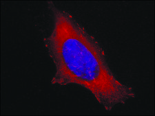 Anti-Vinculin antibody, Mouse monoclonal clone V284, purified from hybridoma cell culture