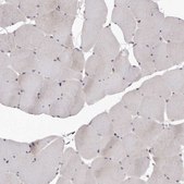 抗-FAS 兔抗 Prestige Antibodies® Powered by Atlas Antibodies, affinity isolated antibody, buffered aqueous glycerol solution