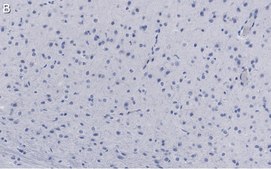 Anti-GluR1 Antibody, clone RH95 ZooMAb® Mouse Monoclonal recombinant, expressed in HEK 293 cells