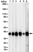 Anti-PPP1A Antibody, clone 1H8 ZooMAb® Rabbit Monoclonal recombinant, expressed in HEK 293 cells