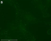 Anti-p-Paxillin-Tyr118 Antibody, clone 1E19 ZooMAb® Rabbit Monoclonal recombinant, expressed in HEK 293 cells