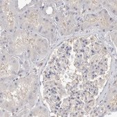 Anti-TOP2A antibody produced in rabbit Prestige Antibodies® Powered by Atlas Antibodies, affinity isolated antibody, buffered aqueous glycerol solution, Ab2