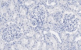 Anti-ZO-1 Antibody, clone 4E14 ZooMAb® Rabbit Monoclonal recombinant, expressed in HEK 293 cells