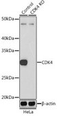 Anti- CDK4 antibody produced in rabbit