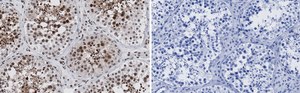 Anti-BRCA1 Antibody, clone 2C15 ZooMAb® Rabbit Monoclonal recombinant, expressed in HEK 293 cells