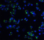 Anti-STIM1 antibody produced in rabbit affinity isolated antibody, buffered aqueous solution
