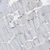 Anti-IQGAP1 antibody produced in rabbit Prestige Antibodies® Powered by Atlas Antibodies, affinity isolated antibody, buffered aqueous glycerol solution