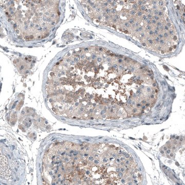 Anti-ABCC11 antibody produced in rabbit Prestige Antibodies® Powered by Atlas Antibodies, affinity isolated antibody, buffered aqueous glycerol solution