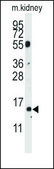 Anti-CDA (center) antibody produced in rabbit saturated ammonium sulfate (SAS) precipitated, buffered aqueous solution
