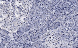 Anti-hnRNP A1 Antibody, clone 9H10 ZooMAb® Mouse Monoclonal recombinant, expressed in HEK 293 cells