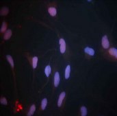 Anti-Dlx2 Antibody Chemicon®, from rabbit