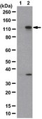 Anti-phospho-MYPT1 (Thr696) Antibody from rabbit, purified by affinity chromatography