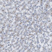 Anti-ABCB11 antibody produced in rabbit Prestige Antibodies® Powered by Atlas Antibodies, affinity isolated antibody, buffered aqueous glycerol solution