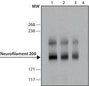 Anti-Neurofilament 200 (Phos and Non-Phos) antibody, Mouse monoclonal clone N52, purified from hybridoma cell culture