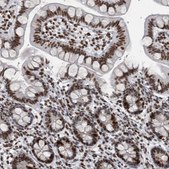 Anti-TOP2B antibody produced in rabbit Prestige Antibodies® Powered by Atlas Antibodies, affinity isolated antibody, buffered aqueous glycerol solution