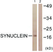 Anti-Synuclein antibody produced in rabbit affinity isolated antibody