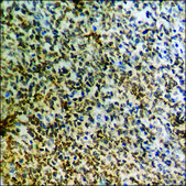 Anti-phospho-Catenin-β (pSer37) antibody produced in rabbit affinity isolated antibody