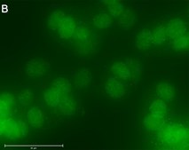 Anti-RARγ1 Antibody, clone 1C22 ZooMAb® Rabbit Monoclonal recombinant, expressed in HEK 293 cells