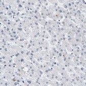 Anti-PCNT antibody produced in rabbit Prestige Antibodies® Powered by Atlas Antibodies, affinity isolated antibody, buffered aqueous glycerol solution, Ab1