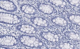 Anti-Na+-K+ ATPase α1 Antibody, clone 1E13 ZooMAb® Rabbit Monoclonal recombinant, expressed in HEK 293 cells