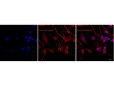 Milli-Mark® 泛神经元标志物 Milli-Mark Pan Neuronal Marker is an antibody targeting the Pan Neuronal Marker protein, validated for use in ICC, IHC, IF &amp; IHC.