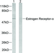 Anti-Estrogen Receptor-α antibody produced in rabbit affinity isolated antibody