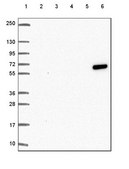 抗-KRT6A 兔抗 Prestige Antibodies® Powered by Atlas Antibodies, affinity isolated antibody, buffered aqueous glycerol solution