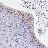 Anti-DDX39B antibody produced in rabbit Prestige Antibodies® Powered by Atlas Antibodies, affinity isolated antibody