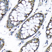 Anti-Hexokinase II antibody produced in rabbit