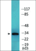 抗-磷酸化-CDK5 (pTyr15) 兔抗 affinity isolated antibody