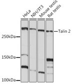 Anti-Talin 2 Antibody, clone 7D1Y0, Rabbit Monoclonal
