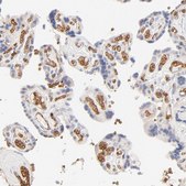 Anti-SPTB antibody produced in rabbit Ab2, Prestige Antibodies® Powered by Atlas Antibodies, affinity isolated antibody, buffered aqueous glycerol solution