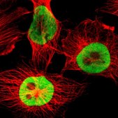ANTI-HNRNPD antibody produced in rabbit Prestige Antibodies® Powered by Atlas Antibodies, affinity isolated antibody, buffered aqueous glycerol solution