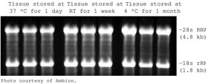 RNAlater® Stabilize and protect RNA with immediate RNase inactivation