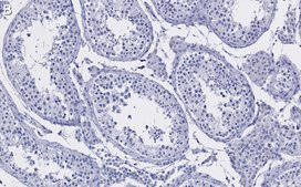 Anti-HDAC2 Antibody, clone 1E22 ZooMAb® Rabbit Monoclonal recombinant, expressed in HEK 293 cells