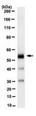 Anti-Retinal Dehydrogenase 1/ALDH1A1 Antibody, clone 16B4.2 clone 16B4.2, from mouse