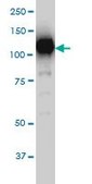 Monoclonal Anti-SIRT1 antibody produced in mouse clone 7B7, purified immunoglobulin, buffered aqueous solution