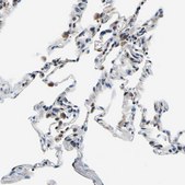 Anti-NLRP3 antibody produced in rabbit Prestige Antibodies® Powered by Atlas Antibodies, affinity isolated antibody, buffered aqueous glycerol solution