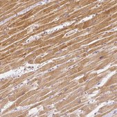 Monoclonal Anti-RHOT1 antibody produced in mouse Prestige Antibodies® Powered by Atlas Antibodies, clone CL1095, purified immunoglobulin, buffered aqueous glycerol solution