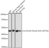 Anti-α-Smooth Muscle Actin (ACTA2) Antibody, clone 2V4L9, Rabbit Monoclonal