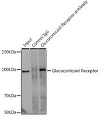 Anti-Glucocorticoid Receptor Antibody, clone 2K3E8, Rabbit Monoclonal