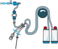 Steritest® NEO Device For medical devices and collapsible bags., Blue base canister provided with 3 adaptors for connecting various test devices.