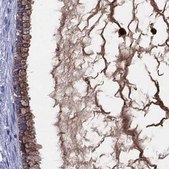 Anti-SERPINA3 antibody produced in rabbit Prestige Antibodies® Powered by Atlas Antibodies, affinity isolated antibody, buffered aqueous glycerol solution