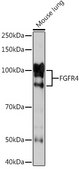 Anti-FGFR4 Antibody, clone 2C4E1, Rabbit Monoclonal