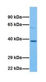 Anti-G6PC antibody produced in rabbit affinity isolated antibody